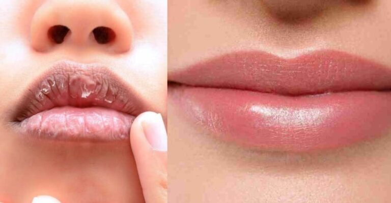 सुर्ख गुलाबी होठों की रखते हैं चाहत तो अपनाए ये तरीके, कुछ ही हफ्तों में दिखेगा जादू